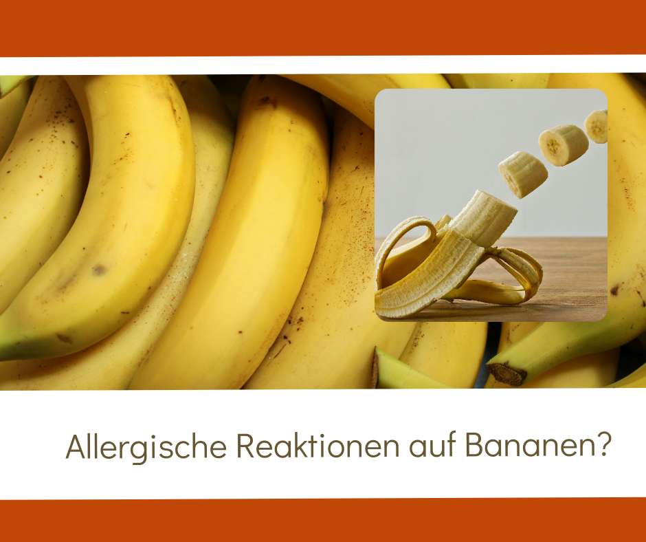 Welche Allergene haben Bananen?